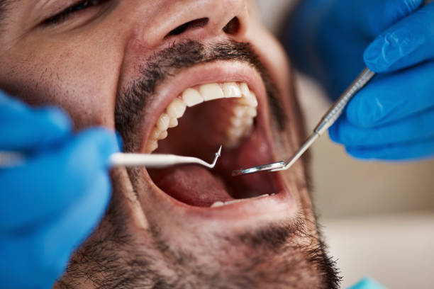 Best Urgent Care for Lost Fillings or Crowns in Warren, IN