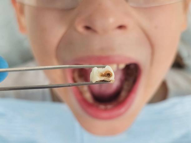 Best Cosmetic Emergency Dentistry in Warren, IN